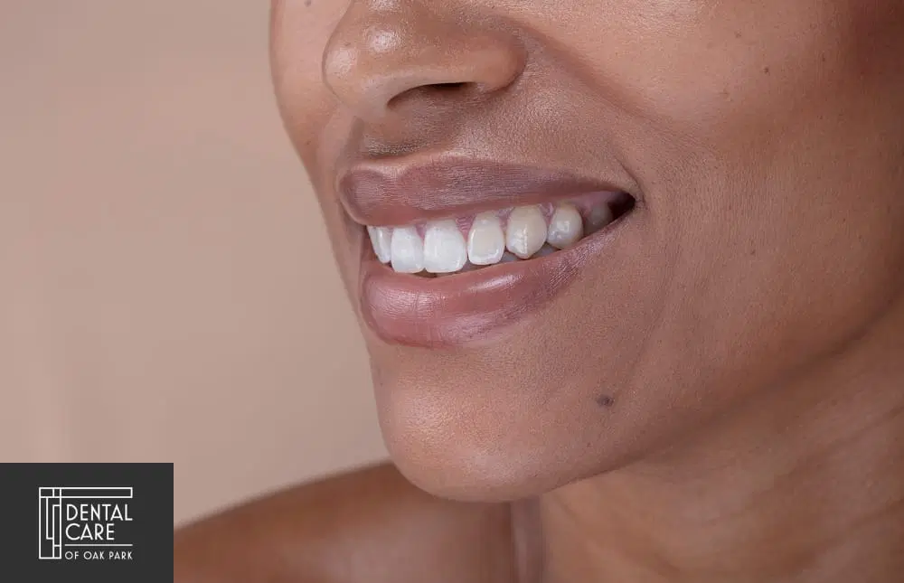 teeth-smile