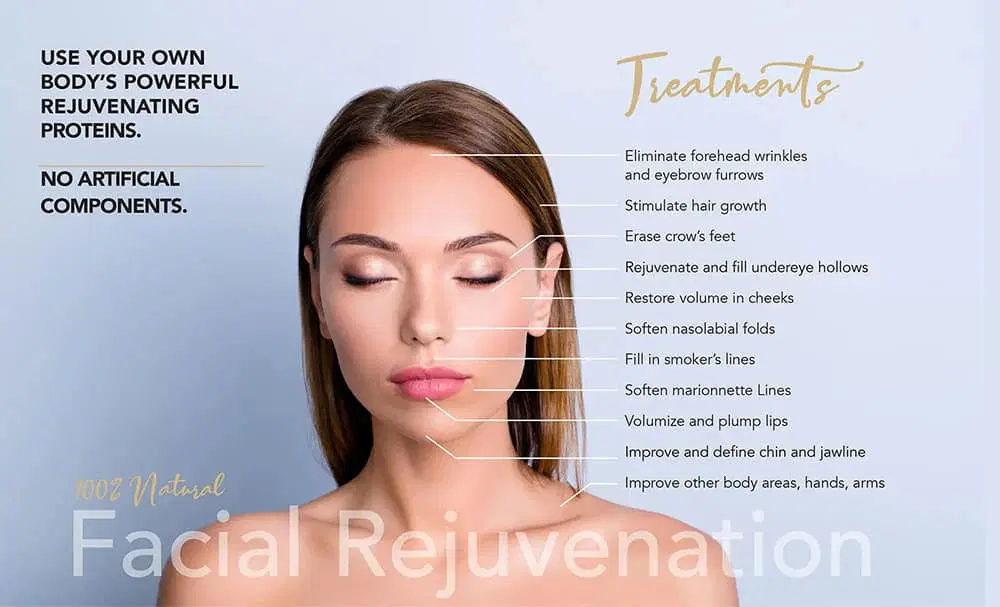 Facial rejuvenation treatment illustrating common aesthetic treatment areas